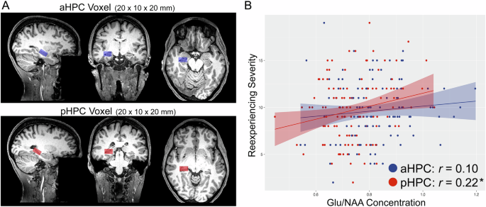 Multimodal associations between posterior hippocampus glutamate metabolism, visual cortex connectivity, and intrusive trauma reexperiencing symptoms