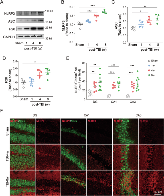 The non-inflammatory effect of neuronal NLRP3 on spatial memory after traumatic brain injury