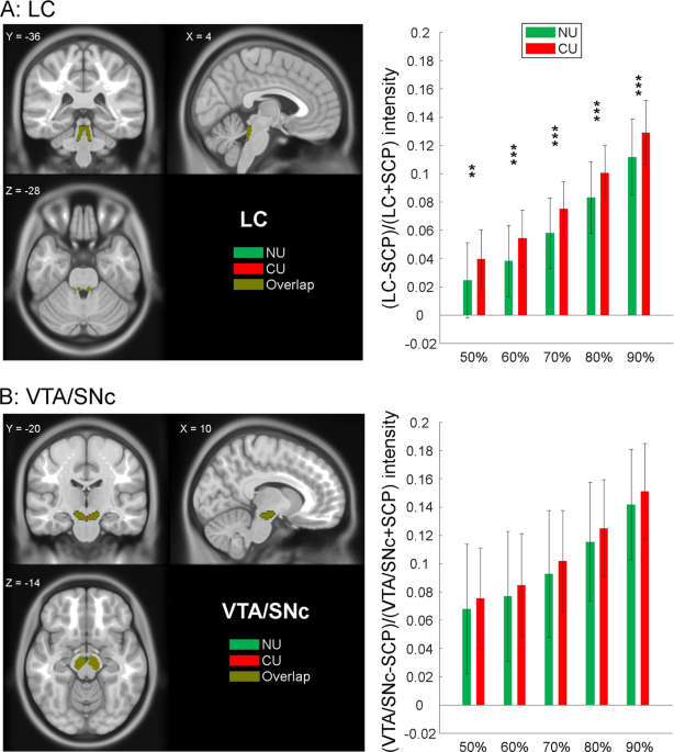 Noradrenergic Correlates Of Chronic Cocaine Craving Neuromelanin And Functional Brain Imaging Neuropsychopharmacology