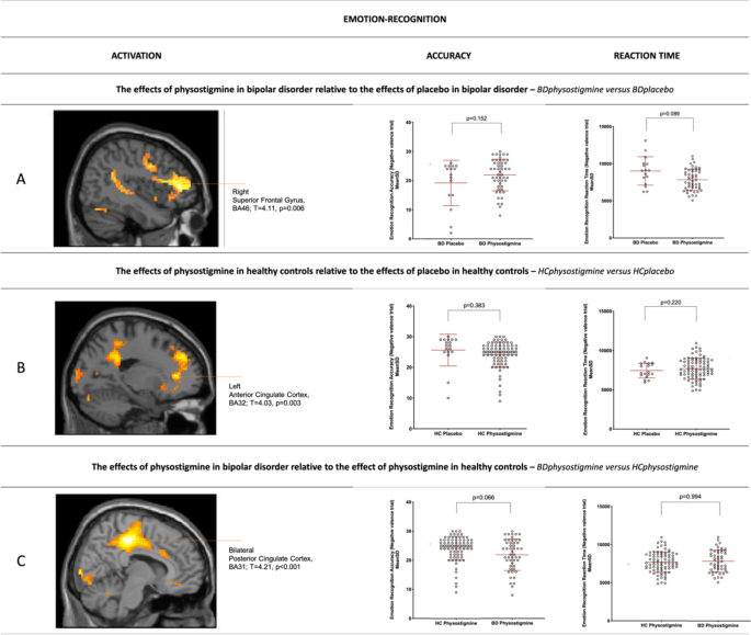 Normalization of impaired emotion inhibition in bipolar disorder mediated by cholinergic neurotransmission in the cingulate cortex