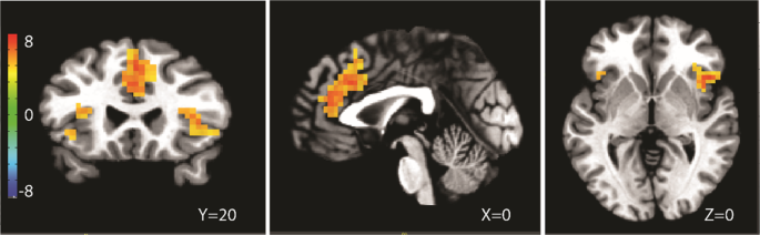 feature-image