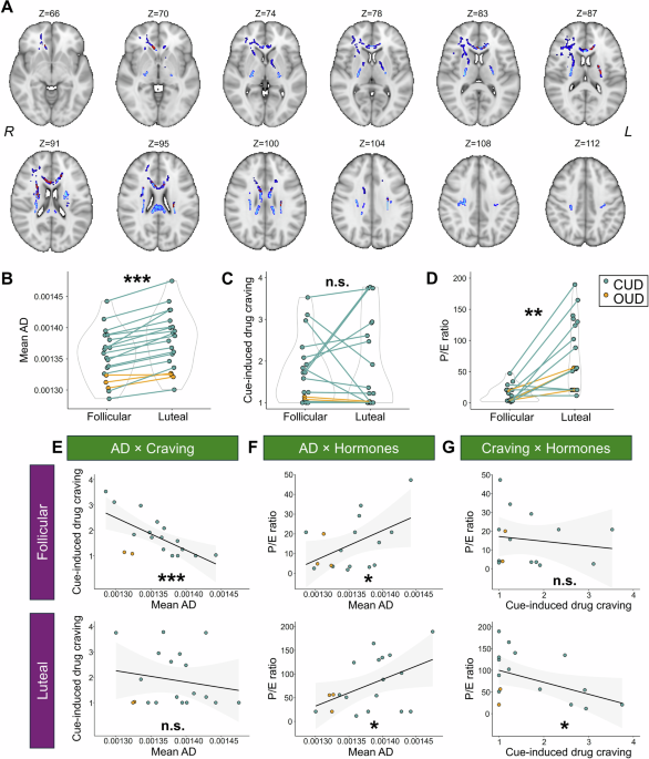 Menstrual cycle-dependent white matter microstructural dynamics in women with substance use disorder