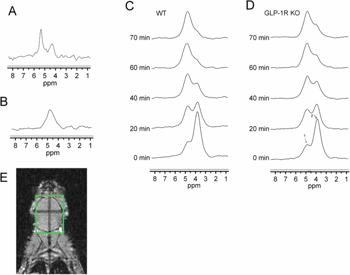 measured glp 1 Impaired brain glucose metabolism in glucagon-like peptide-1 receptor  knockout mice