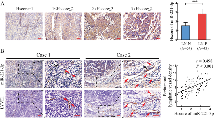 Cervical Squamous Cell Carcinoma Secreted Exosomal Mir 221 3p Promotes Lymphangiogenesis And Lymphatic Metastasis By Targeting Vash1 Oncogene