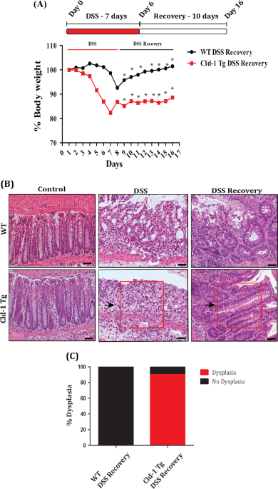 Upregulated claudin-1 expression promotes colitis-associated cancer by promoting β-catenin phosphorylation and activation in notch/p-akt-dependent manner