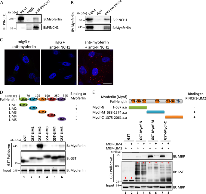 Pinch 1 Interacts With Myoferlin To Promote Breast Cancer Progression And Metastasis Oncogene