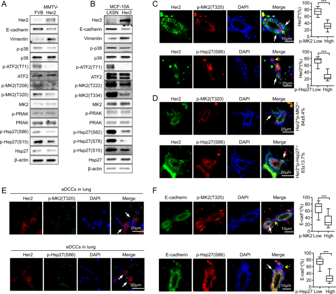 Her2 Promotes Early Dissemination Of Breast Cancer By Suppressing The P38 Mk2 Hsp27 Pathway That Is Targetable By Wip1 Inhibition Oncogene