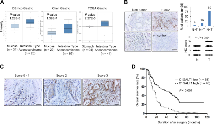 C1galt1 is associated with poor survival and promotes soluble ephrin a1-mediated cell migration through activation of epha2 in gastric cancer
