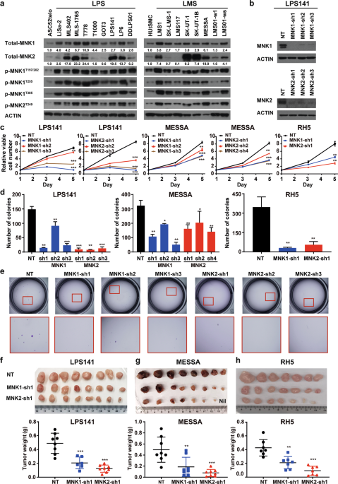 Mnk1 And Mnk2 Enforce Expression Of E2f1 Foxm1 And Wee1 To Drive Soft Tissue Sarcoma Oncogene Mnk1 And Mnk2 Enforce Expression Of E2f1 Foxm1 And Wee1 To Drive Soft Tissue Sarcoma Oncogene