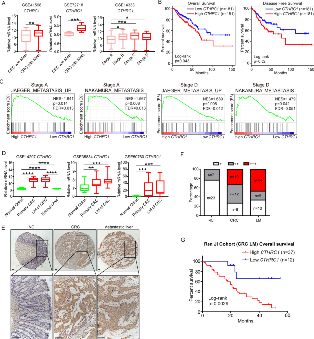 Cthrc1 promotes liver metastasis by reshaping infiltrated macrophages through physical interactions with tgf-β receptors in colorectal cancer