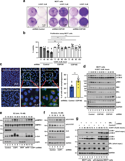 The E3 ligase COP1 promotes ERα signaling and suppresses EMT in breast  cancer | Oncogene