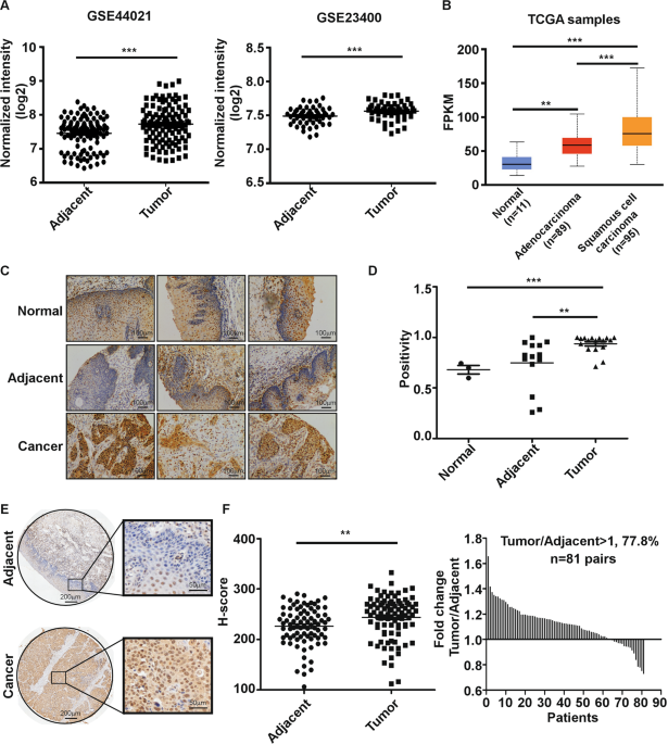 Brd4 drives esophageal squamous cell carcinoma growth by promoting rcc2 expression