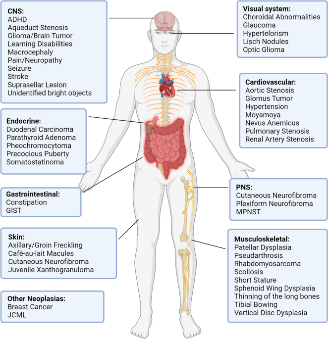 glutathione kill neurofibromas The clinical landscape of cutaneous in neurofibromatosis type 1 Frontiers | Neurofibromatosis: Molecular Pathogenesis