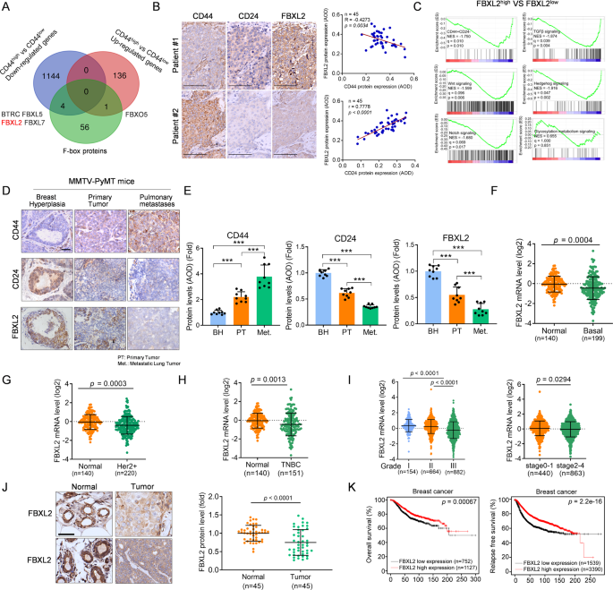 FBXL2 promotes E47 protein instability to inhibit breast cancer stemness  and paclitaxel resistance | Oncogene