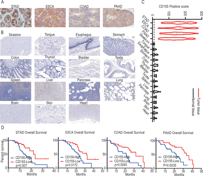 Preclinical application of a CD155 targeting chimeric antigen receptor ...