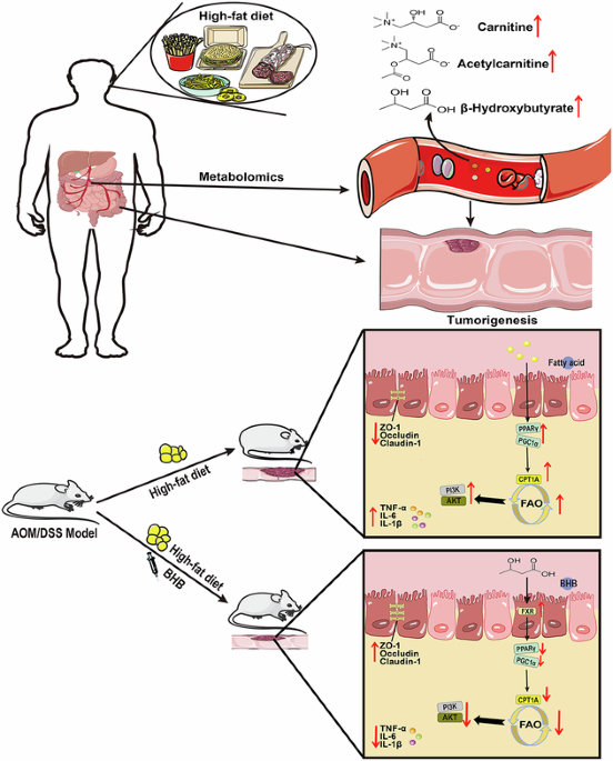 l carnitine graves disease High-fat diet promotes colorectal cancer via carnitine/acetylcarnitine-driven  CPT1A metabolic reprogramming and the intervention of β-hydroxybutyrate