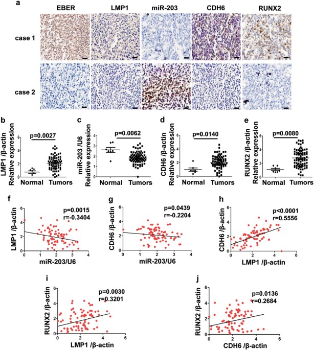Retracted article: cadherin 6 is activated by epstein–barr virus lmp1 to mediate emt and metastasis as an interplay node of multiple pathways in nasop