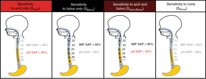 Differentiating esophageal sensitivity phenotypes using pH–impedance in  intensive care unit infants referred for gastroesophageal reflux symptoms |  Pediatric Research