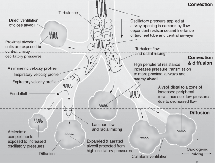 High-frequency ventilation in preterm infants and neonates 