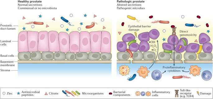 Fecal Enterococcus és prostatitis