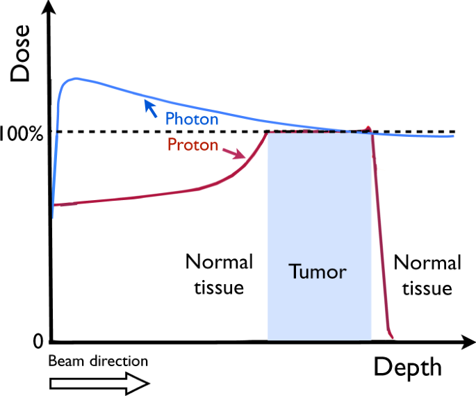 Proton versus photon-based radiation therapy for prostate cancer: emerging  evidence and considerations in the era of value-based cancer care |  Prostate Cancer and Prostatic Diseases