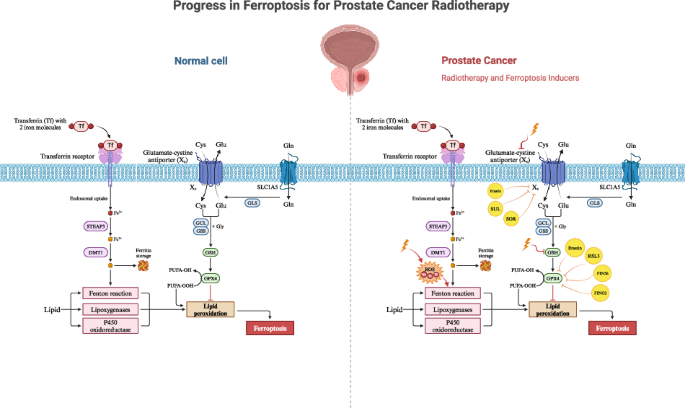 dr kwon glutathione Advances in ferroptosis for castration-resistant prostate cancer treatment: novel drug targets and combination therapy strategies