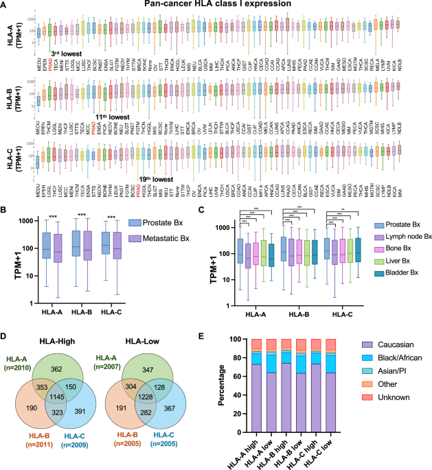 HLA class I expression shapes the tumor immune microenvironment and ...