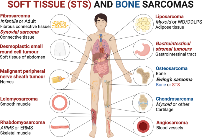 Molecular mechanisms underpinning sarcomas and implications for current and  future therapy | Signal Transduction and Targeted Therapy