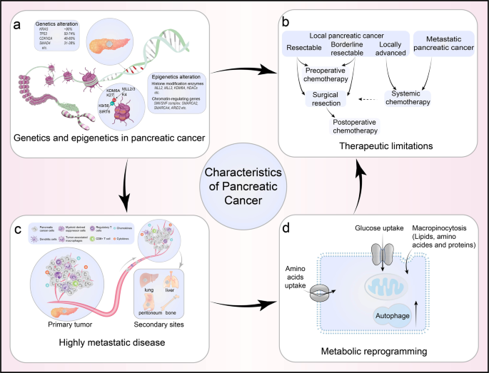 pancreas cancer