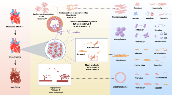 Signaling pathways and targeted therapy for myocardial infarction | Signal  Transduction and Targeted Therapy