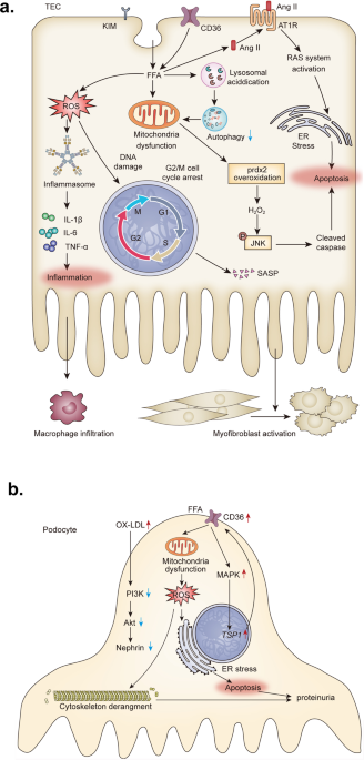 Signaling pathways of chronic kidney diseases, implications for  therapeutics
