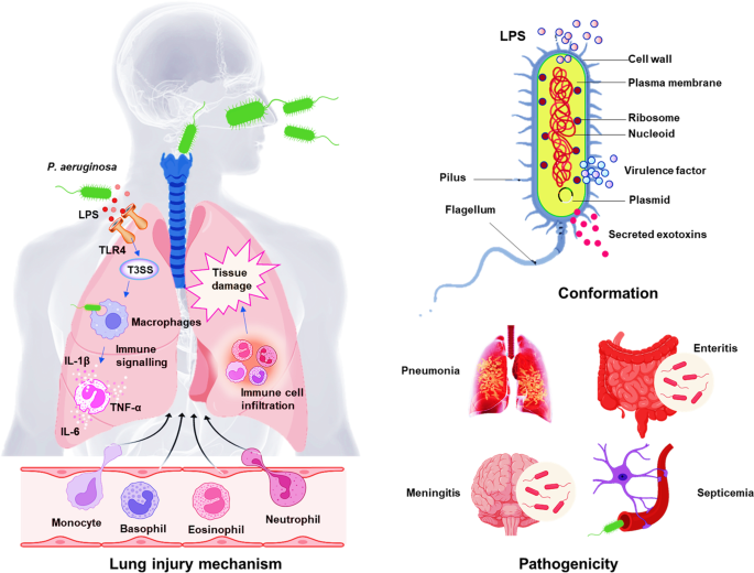 Pseudomonas Aeruginosa: Pathogenesis, Virulence Factors, Antibiotic  Resistance, Interaction With Host, Technology Advances And Emerging  Therapeutics | Signal Transduction And Targeted Therapy