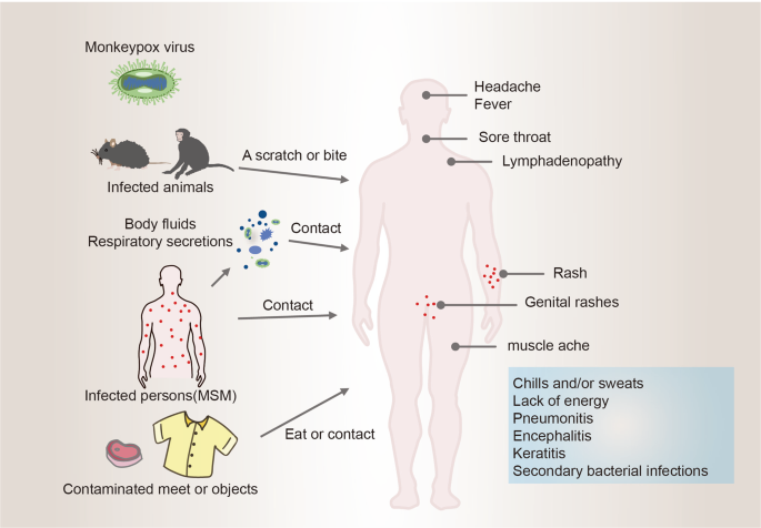 This figure demonstrates newly developing monkeypox lesions along the