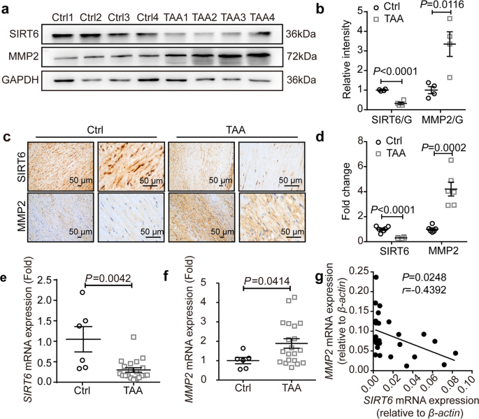 SIRT6 is an epigenetic repressor of thoracic aortic aneurysms via inhibiting inflammation and senescence