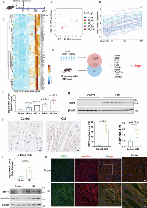 Z-DNA-binding protein 1 exacerbates myocardial ischemia‒reperfusion ...