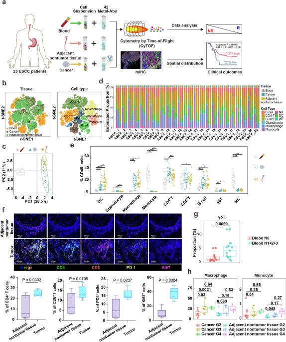 Single-cell atlas of the esophageal squamous cell carcinoma immune ...