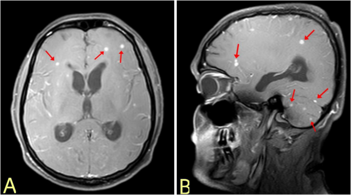 The scan's results