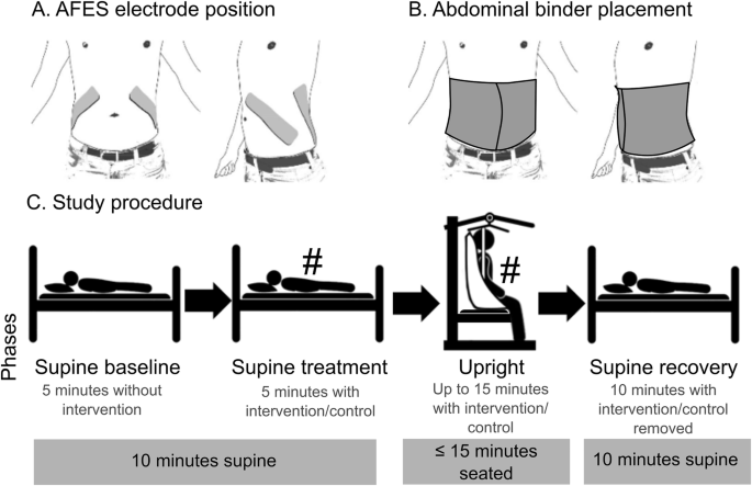 Abdominal functional electrical stimulation and binder to reduce orthostatic hypotension in individuals with a subacute spinal cord injury