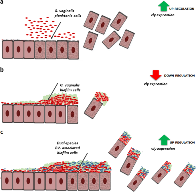 Unveiling the role of Gardnerella vaginalis in polymicrobial Bacterial
