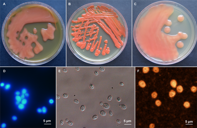 Novel antarctic yeast adapts to cold by switching energy metabolism and increasing small rna synthesis