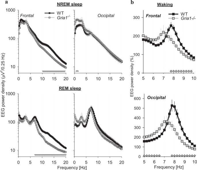 Absent sleep EEG spindle activity in GluA1 (Gria1) knockout mice