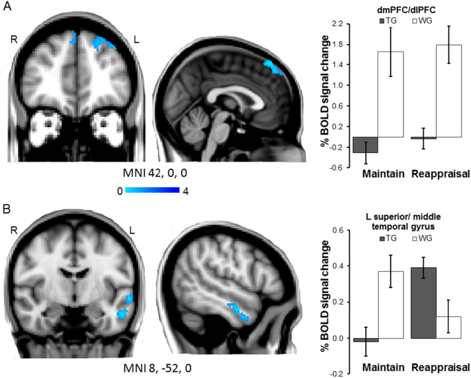 Anxiety May Alter Processing Of >> Early Effects Of Exposure Based Cognitive Behaviour Therapy On The Anxiety May Alter Processing Of >> Early Effects Of Exposure Based Cognitive Behaviour Therapy On The