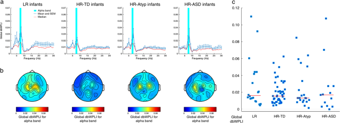 Functional EEG connectivity in infants associates with later restricted ...