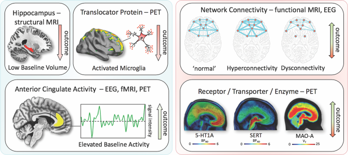 Prognosis and improved outcomes in major depression: a review | Translational Psychiatry Prognosis and improved outcomes in major depression: a review | Translational Psychiatry