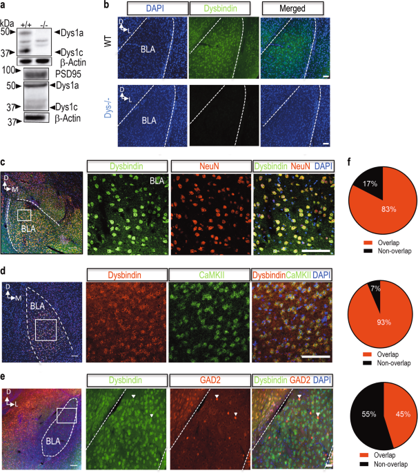 Deletion Of Dtnbp1 In Mice Impairs Threat Memory Consolidation And Is Associated With Enhanced Inhibitory Drive In The Amygdala Translational Psychiatry