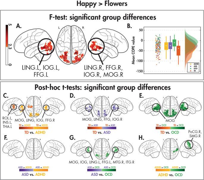 Emotional Face Processing Across Neurodevelopmental Disorders A Dynamic Faces Study In Children With Autism Spectrum Disorder Attention Deficit Hyperactivity Disorder And Obsessive Compulsive Disorder Translational Psychiatry