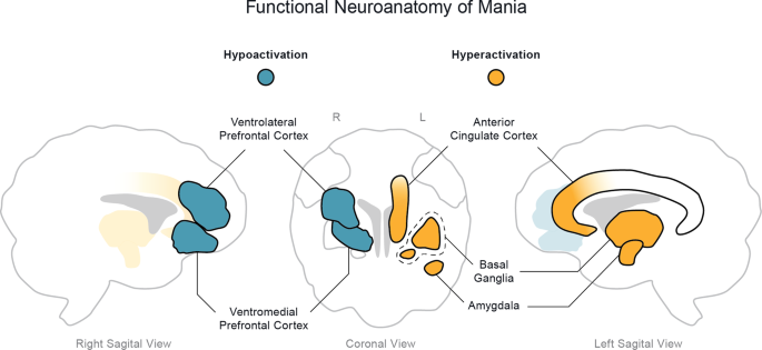 Functional neuroanatomy of mania | Translational Psychiatry