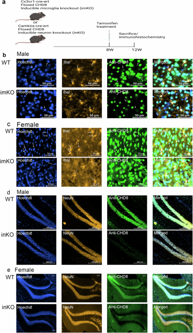 A brain scan highlighting neural activity