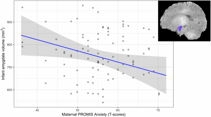 The association between prenatal maternal anxiety, infant brain volumes, and temperament during the COVID-19 pandemic