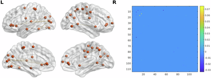 Identifying a structural brain network for social anxiety: connectome-based predictive modeling and network analyses in a transdiagnostic sample